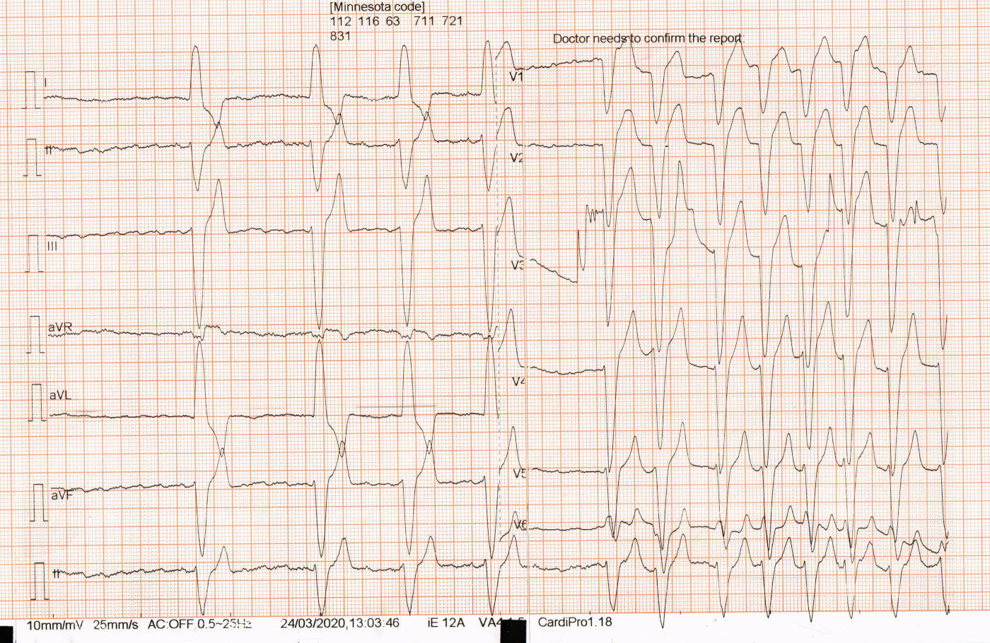 RAMADASS awmi  svt CHANGES002.jpg